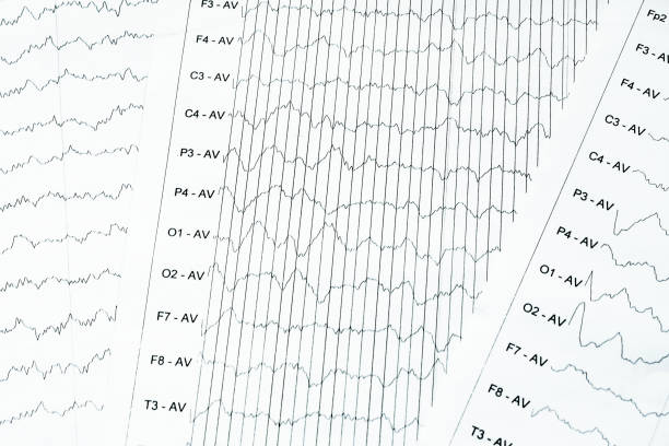 eeg elektrophysiologische monitoring-methode. eeg-welle im menschlichen gehirn, gehirnwellenmuster auf elektroenzephalogramm, eeg des kindes - eeg epilepsy science electrode stock-fotos und bilder