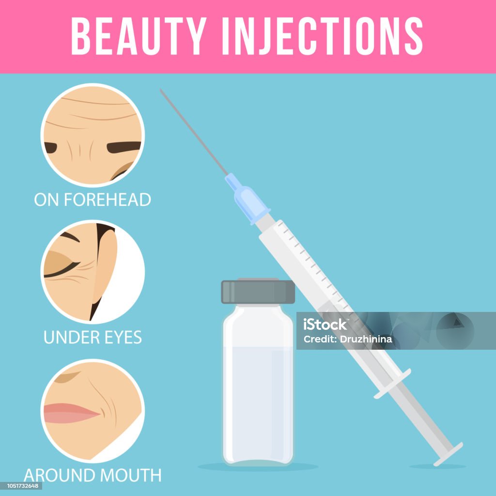 Procédures cosmétiques botox - clipart vectoriel de Acide hyaluronique libre de droits