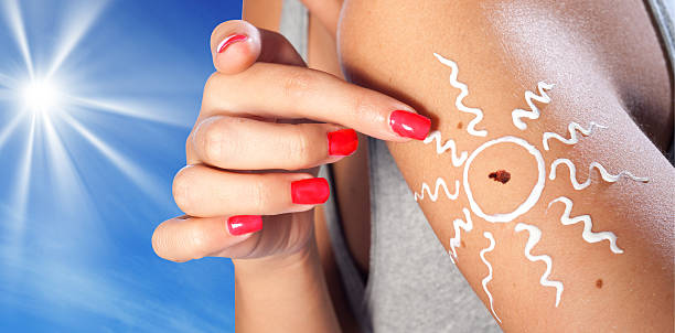 skin cancer melanoma stock photo