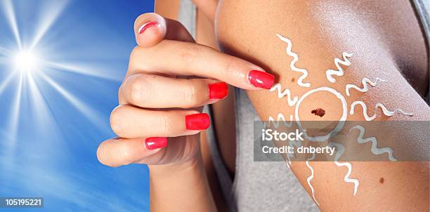 Skin Cancer Melanoma Stock Photo - Download Image Now - Melanoma, Sun, Sunlight