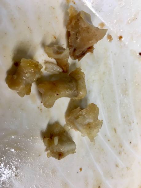 istock Pig knuckle Bone after a meal on dirty dish 1052173152