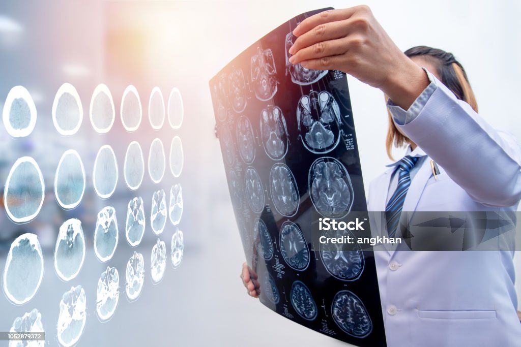 woman doctor holding MRI film to diagnosis injury area of brain woman doctor holding MRI film to diagnosis injury area of brain with double exposure of brain CT scan Brain Damage Stock Photo