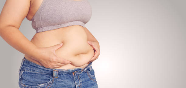 istock Fat woman touching her stomach 1052983448