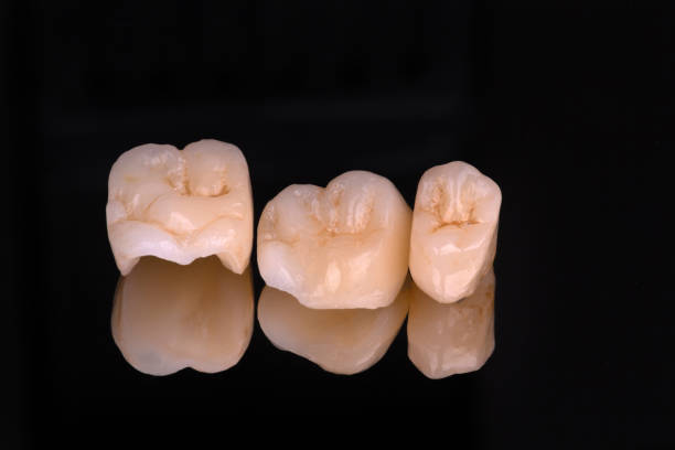 istock dental ceramic veneers and crowns isolated with mirror background. 1053236634