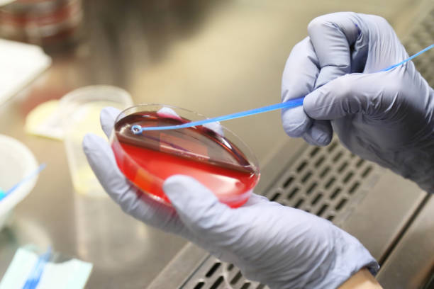 cultura en las orina y la sangre de petri - petri dish laboratory bacterium microbiology fotografías e imágenes de stock