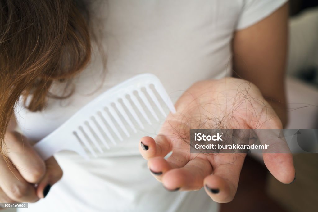 Woman losing hair on hairbrush in hand Hair Loss Stock Photo
