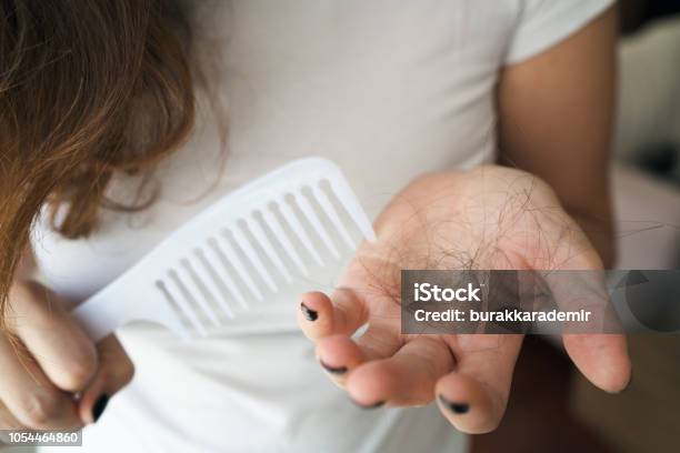 Woman Losing Hair On Hairbrush In Hand Stock Photo - Download Image Now - Hair Loss, Women, One Woman Only