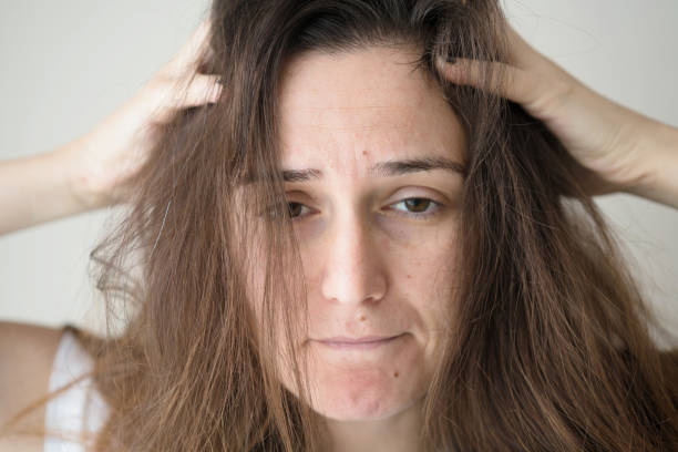 istock Upset woman with messy hair 1054470432