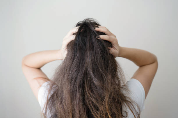 istock Upset woman with messy hair 1054470664
