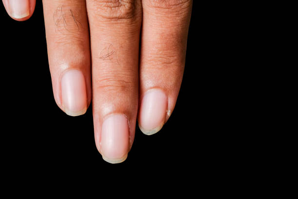 istock closeup Dermatitis detail 1054768872