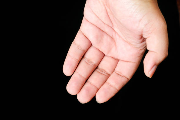 istock closeup Dermatitis detail 1054770382