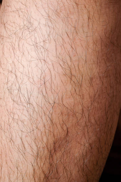 istock closeup Dermatitis detail 1054771016
