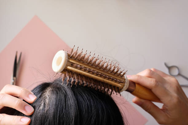 istock hair fall and lost alopecia woman problem on the comb. 1054860822
