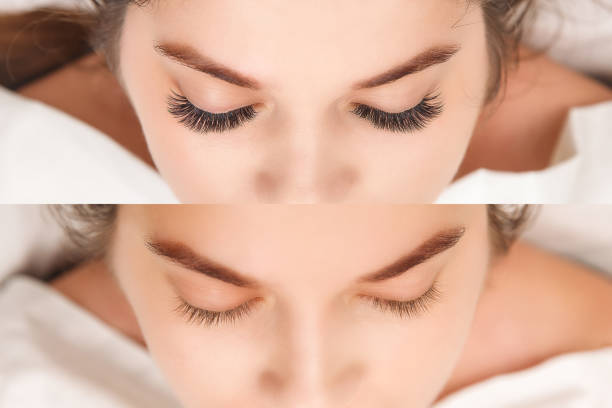 istock Eyelash Extension. Comparison of female eyes before and after. 1054989702