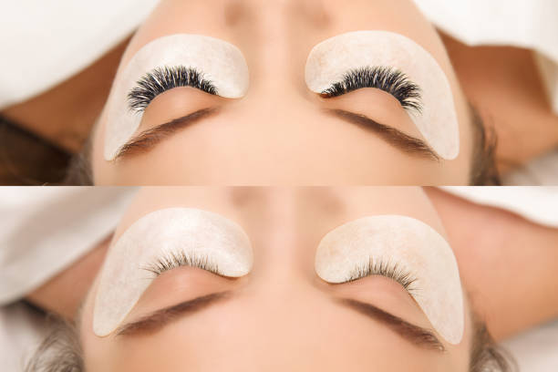 istock Eyelash Extension. Comparison of female eyes before and after. 1054989710
