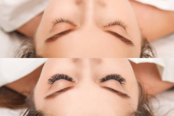 istock Eyelash Extension. Comparison of female eyes before and after. 1054989716