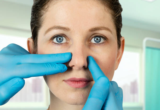nose beauty surgery in hospital - nose job imagens e fotografias de stock