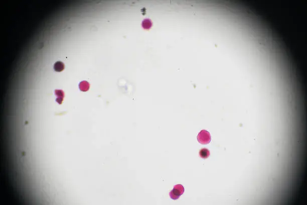 Vegetable Pollen W.M. under light microscopy