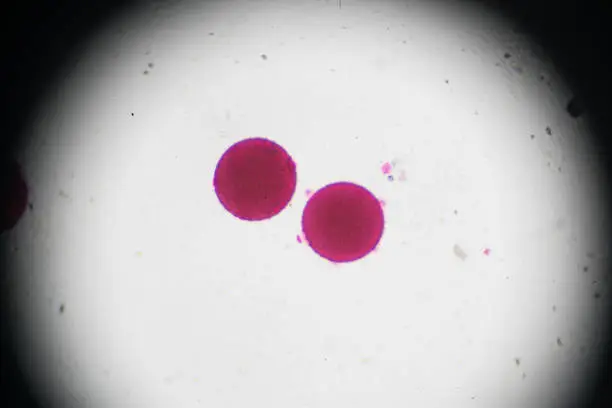 Vegetable Pollen W.M. under light microscopy