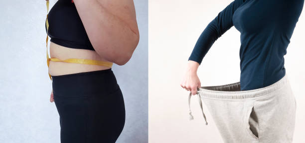 istock girl slimming before and after the diet 1055408826