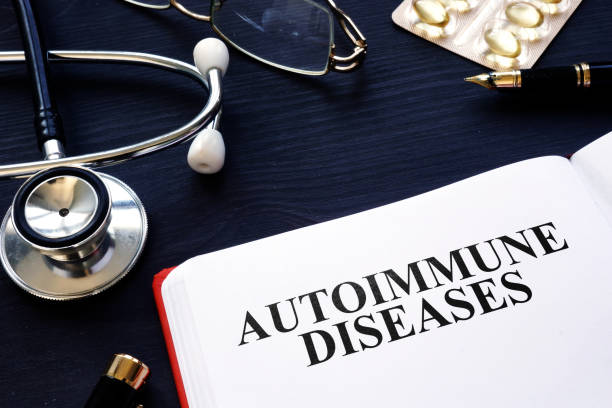 istock Autoimmune diseases. Book, pills and stethoscope on the desk. 1055976242