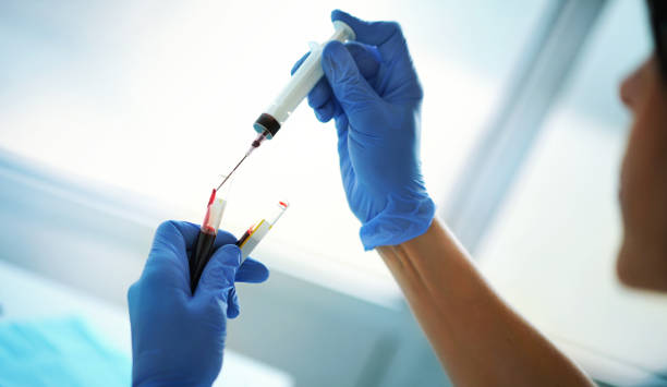 Blood test procedure. Closeup over the shoulder view of a nurse filling vials with a blood patient's blood samples just after drawing the blood. sexually transmitted disease stock pictures, royalty-free photos & images