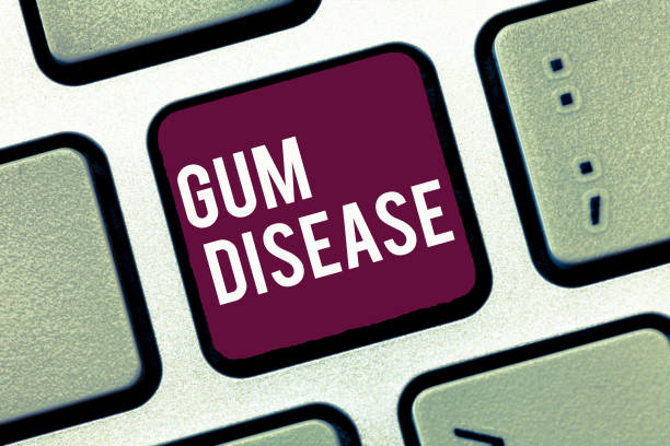 istock Handwriting text writing Gum Disease. Concept meaning Inflammation of the soft tissue Gingivitis Periodontitis 1056061540