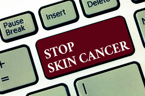 istock Word writing text Stop Skin Cancer. Business concept for Avoiding prolong exposure to ultraviolet radiation 1056072194