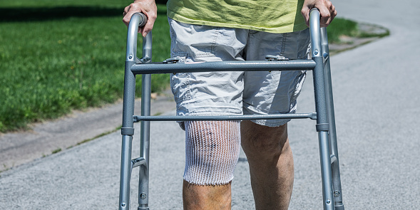 A day in the life of a real person, real life recent knee replacement surgery medical patient senior adult woman. She is patiently, but rigorously doing her prescribed physical therapy by walking slowly and carefully for increasing daily distances back and forth on the street in front of her suburban home. She supports herself with an orthopedic mobility walker. The open mesh bandage around her right knee protects and supports the wound and stitches at the surgery site while allowing constant fresh air to help the healing process. Part of a 