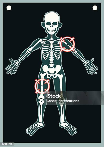 Человеческого Тела X Ray — стоковая векторная графика и другие изображения на тему Грудная клетка - Грудная клетка, Люди, Скелет человека