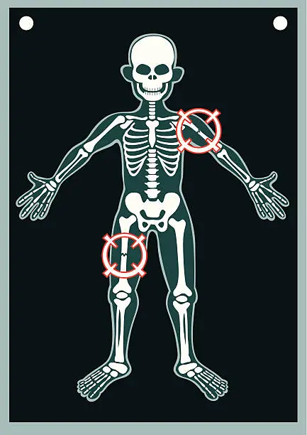 Vector illustration of Human Body X Ray