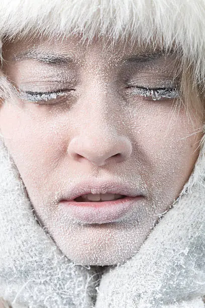 Photo of Very cold weather. Chilled female face covered in ice.