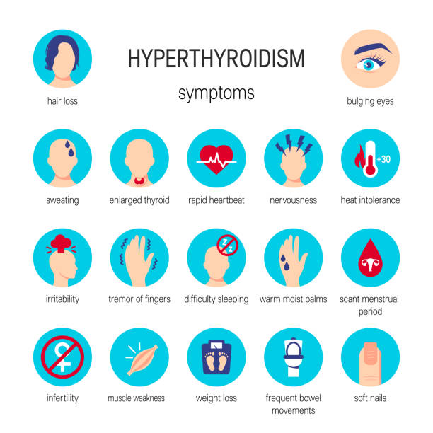 illustrations, cliparts, dessins animés et icônes de symptômes de l’hyperthyroïdie vector - symptome