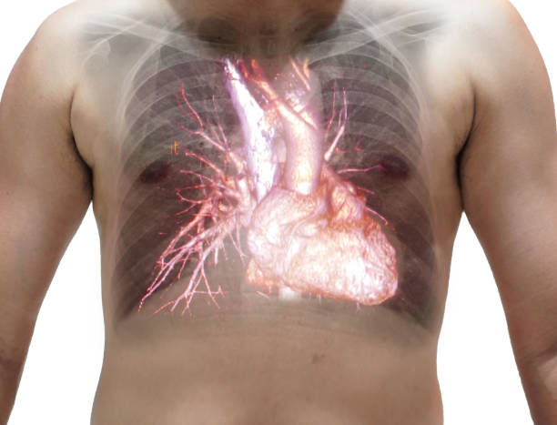 istock Close up Chest x-ray showing heart in side 1056690852