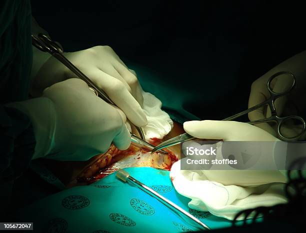 Under The Knife Stock Photo - Download Image Now - Caesarean Section, Childbirth, Close To