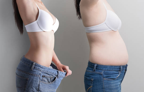 frau mit bauch-verlust-konzept - overweight tummy tuck abdomen body stock-fotos und bilder