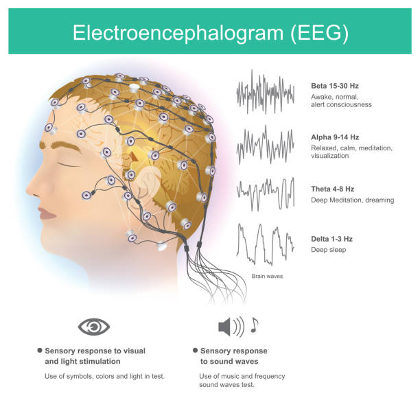 illustrazioni stock, clip art, cartoni animati e icone di tendenza di elettroencefalogramma (eeg). - eeg epilepsy science electrode