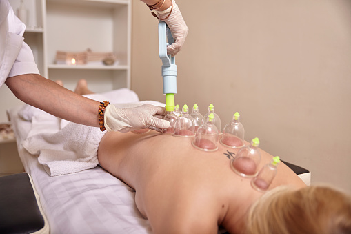 woman using vacuum gun for cupping therapy, close up.