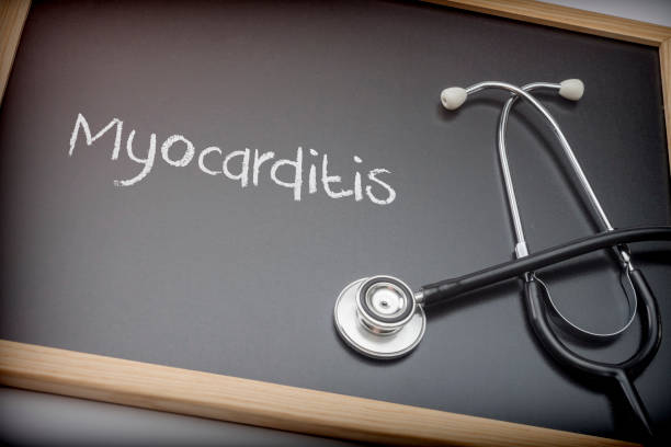 Word Myocarditis written in chalk on a blackboard black next to a stethoscope, conceptual image Word Myocarditis written in chalk on a blackboard black next to a stethoscope, conceptual image pericarditis stock pictures, royalty-free photos & images