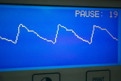 Plethysmograph waveform of Pulse Oximeter  on monitor.