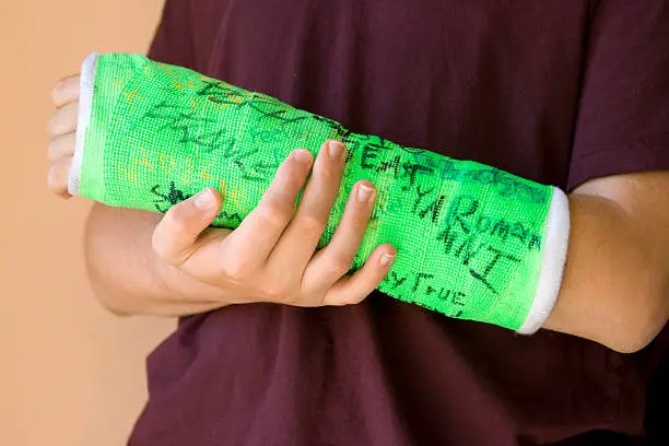 Photo of green cast