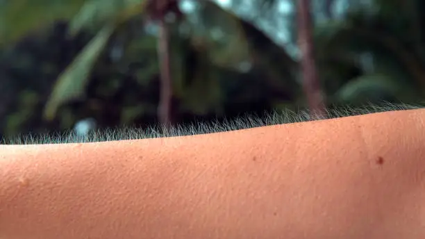 CLOSE UP, MACRO, DOF: Unknown adult person twists and turns their arm to show their goosebumps. Young female shivers in the chilly breeze coming from the ocean. Woman gets cold and starts trembling.