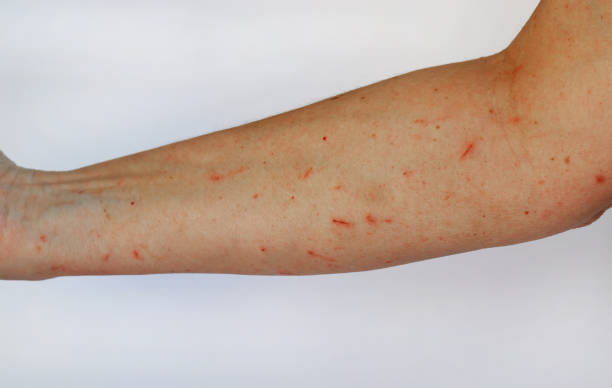 istock A woman has injuries and cuts on her arm 1057691690