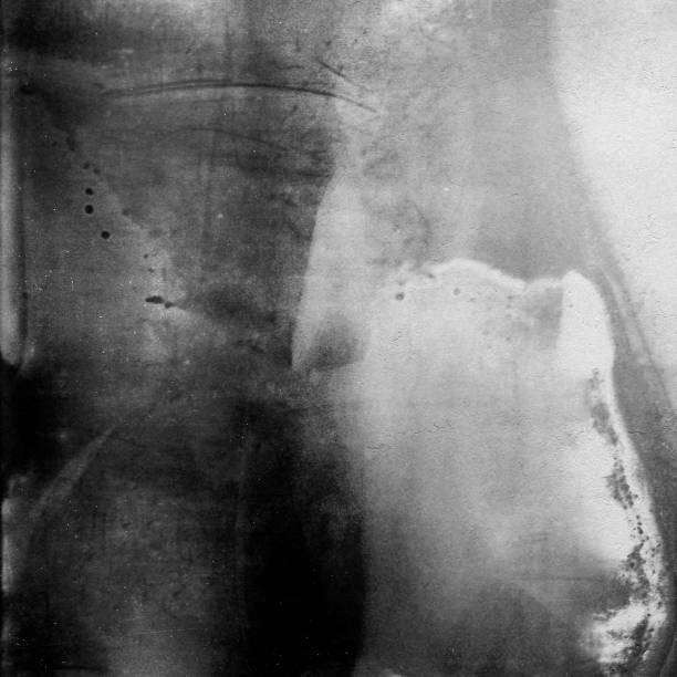istock Black and white medium format film background with grain and light leak. 1057953824