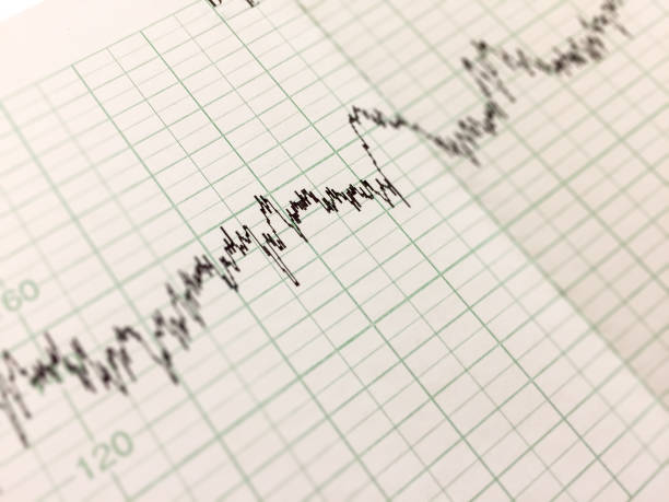 istock Printing of cardiogram report 1058004440
