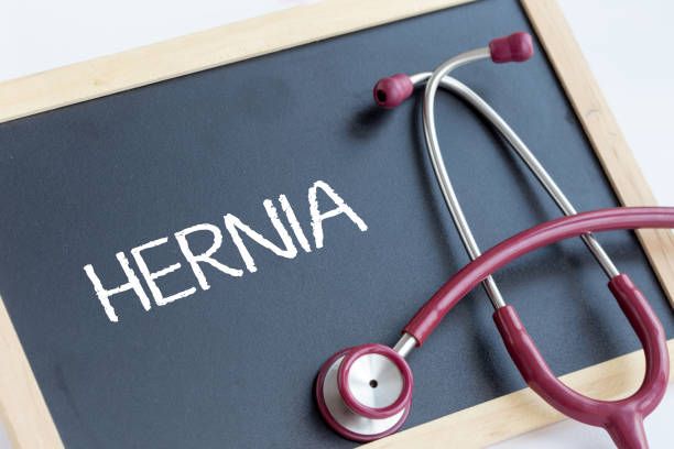 HERNIA CONCEPT HERNIA CONCEPT hernia photos stock pictures, royalty-free photos & images