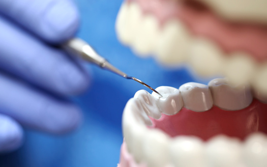 Close-up view of dentist hands on work
