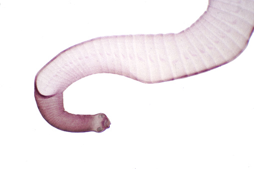 Tapeworm (Parasitic flatworm) of cattle and other grazing animals under the microscope for education.