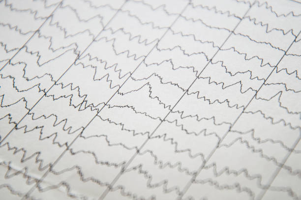 istock Brain wave on electroencephalogram, EEG chart, EEG of children's brain. 1059095446