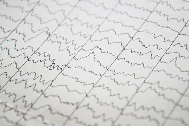 мозговая вол�на на электроэнцефалограмме, ээг диаграмма, ээг детского мозга. - pulse trace computer monitor eeg equipment стоковые фото и изображения